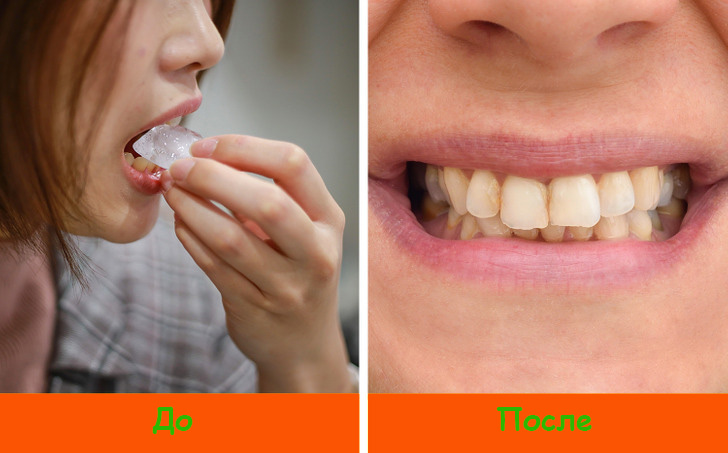 6 способов безопасно отбелить зубы в домашних условиях 
